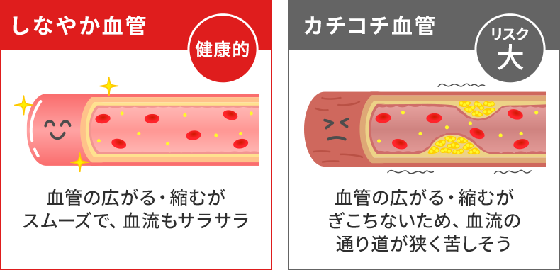 しなやか血管健康的、カチコチ血管リスク大